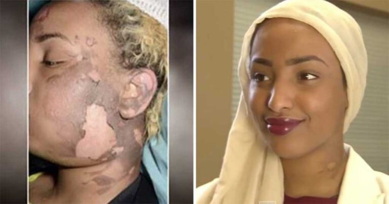 Έκανε τατουάζ στο μισό της πρόσωπο και η ζωή της άλλαξε με τρόπους που δεν μπορείτε να φανταστείτε.