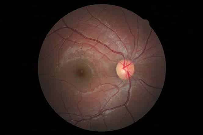 pragmata-pou-pithanotata-vlepete-gia-prwti-fora-13