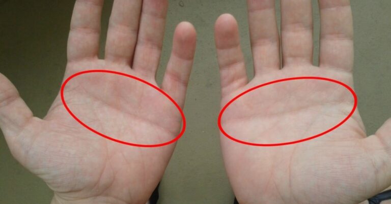 Αν έχετε αυτή την ευθεία γραμμή στην παλάμη σας, ανήκετε στο 10% του πληθυσμού.