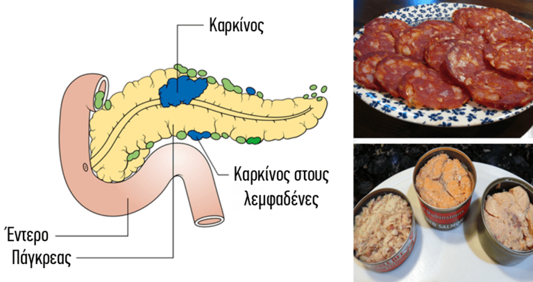 14 τροφές που έχουν αποδειχθεί ότι προκαλούν καρκίνο δεν πρέπει να ξαναβάλετε στο στόμα σας