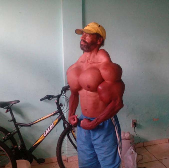 paramorfwthike-me-kataxrisi-synthol-03