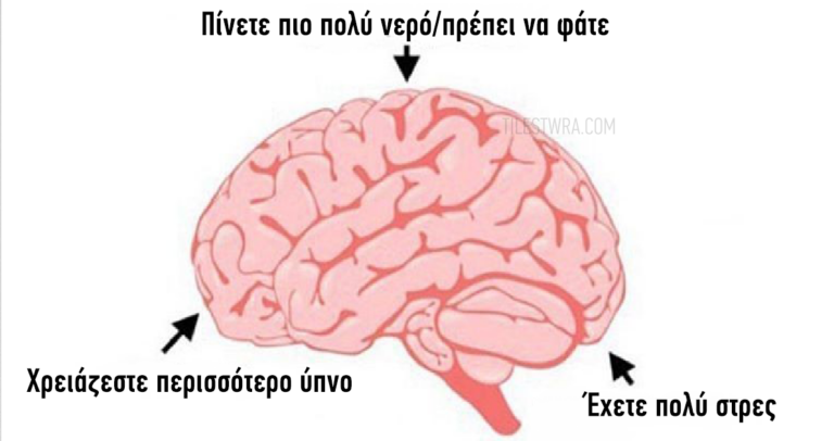 13 λόγοι που ο πονοκέφαλος επιμένει.