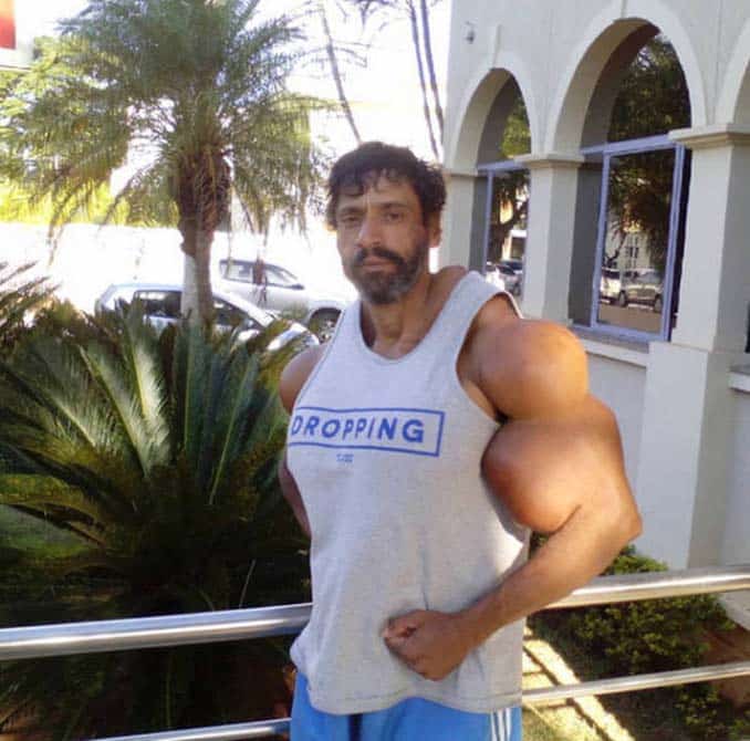 paramorfwthike-me-kataxrisi-synthol-06