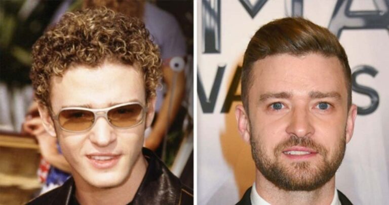 Δείτε πως ήταν διάσημοι τραγουδιστές στις αρχές της καριέρας τους και πως είναι τώρα