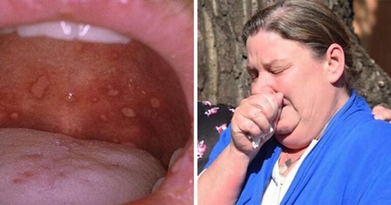 Μην αφήνετε κανέναν να φιλάει το παιδί σας στα χείλη