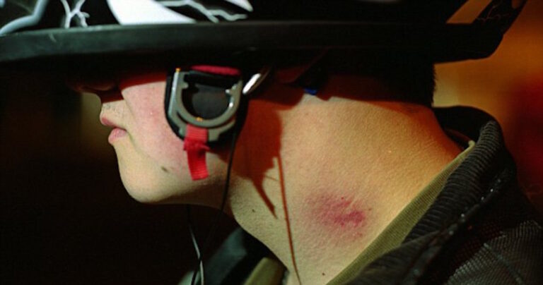 17χρονος έφηβος πέθανε μετά από πιπιλιά που του έκανε η κοπέλα του