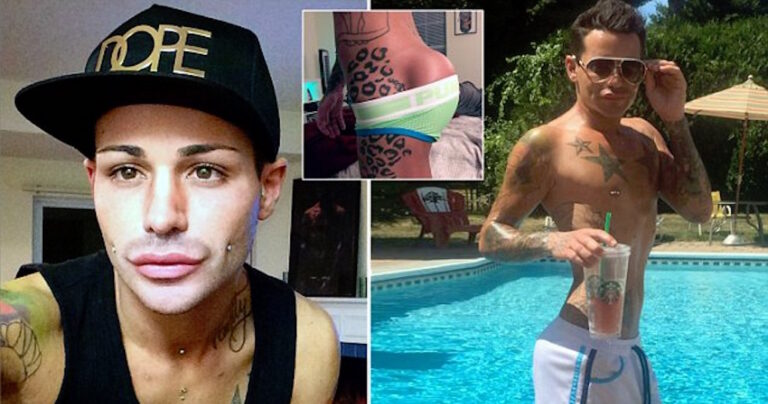 Άνδρας σπαταλά χιλιάδες δολάρια για να αποκτήσει τα οπίσθια των ονείρων του