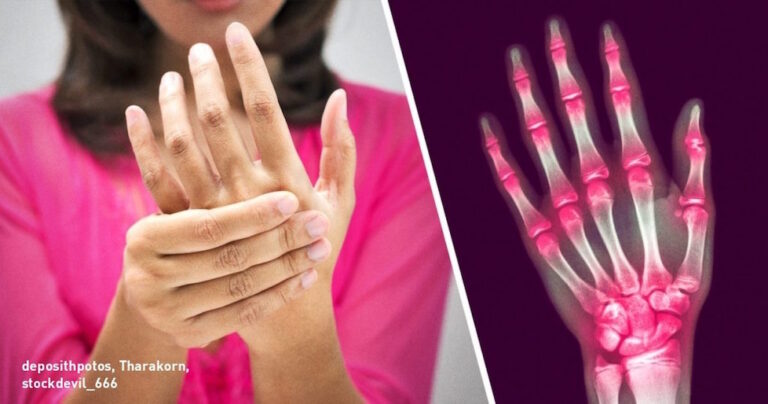 Οι επιστήμονες δίνουν οριστική απάντηση σχετικά με τη βλάβη από το «σπάσιμο» των αρθρώσεων