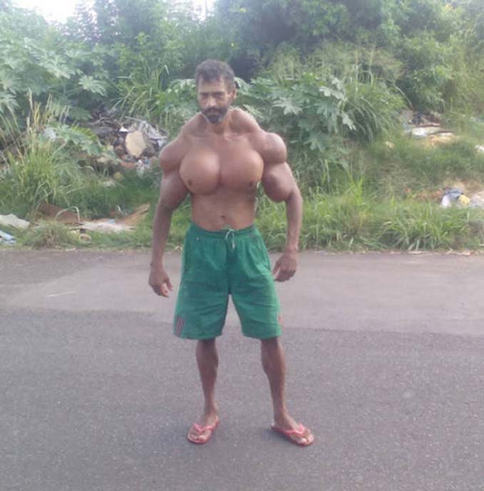 paramorfwthike-me-kataxrisi-synthol-18