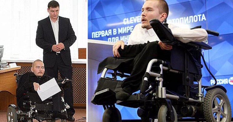 Άνδρας από τη Ρωσία ο πρώτος άνθρωπος που θα υποβληθεί σε μεταμόσχευση κεφαλιού