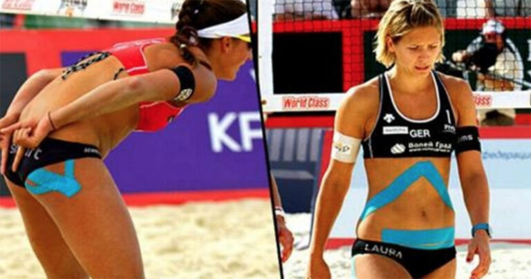 Ο λόγος που οι αθλητές κολλάνε ταινίες πάνω στο σώμα τους είναι απλά πανέξυπνος