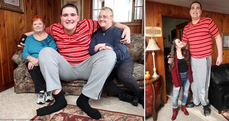 Έφηβος πάσχει από σπάνιο σύνδρομο γιγαντισμού και έχει ύψος 2,34 μέτρα.