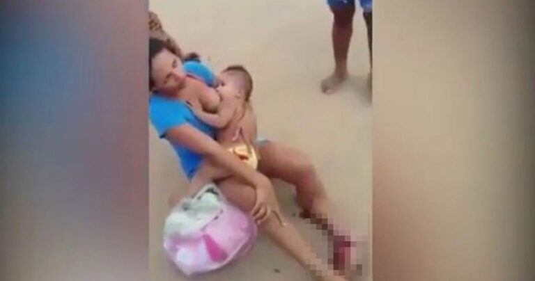 Μητέρα με τσακισμένο πόδι θηλάζει το μωρό της μετά από ατύχημα με μοτοσικλέτα για να το ηρεμήσει