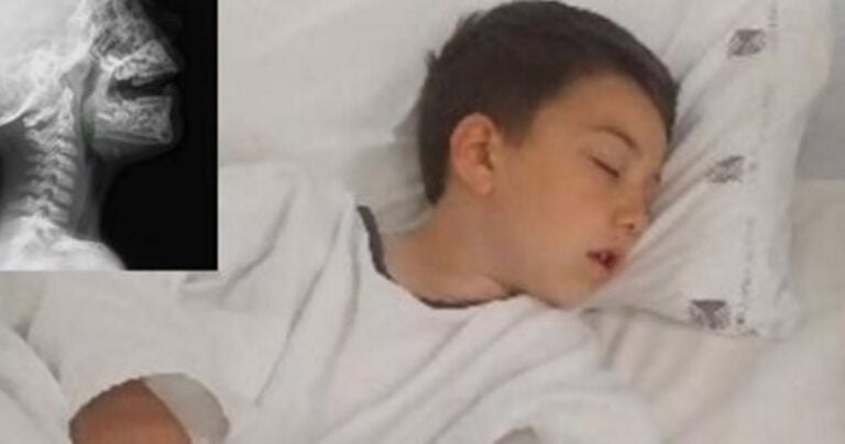 Γιατροί προειδοποιούν να μην πλένουμε την ψησταριά με συρματόβουρτσα