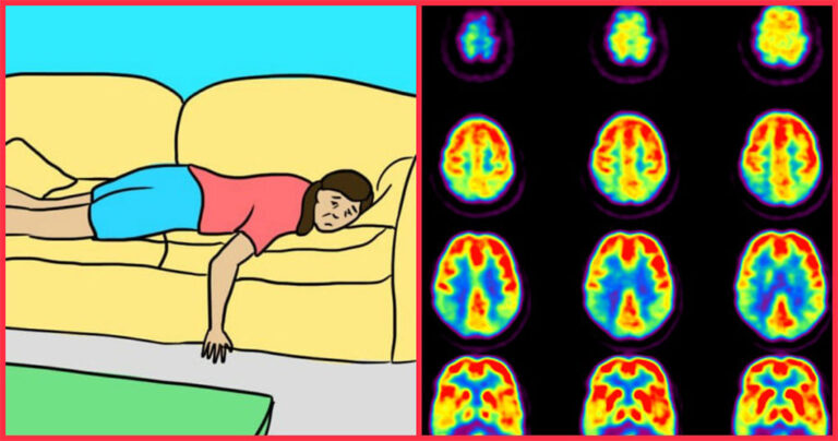 12 συμπτώματα της άνοιας που καμία γυναίκα δεν πρέπει να αγνοεί