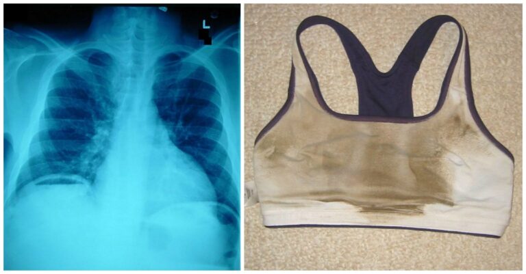 9 πράγματα που ίσως κάνετε λάθος στο σώμα σας καθημερινά.