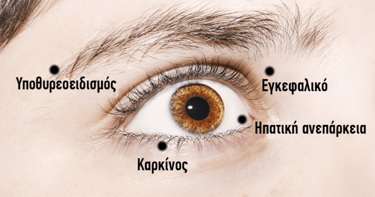 8 πράγματα που προσπαθούν να σας πουν τα μάτια σας για την υγεία σας