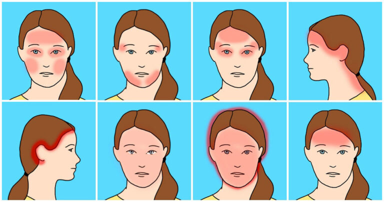 10 κοινά είδη πονοκεφάλων και οι αιτίες τους