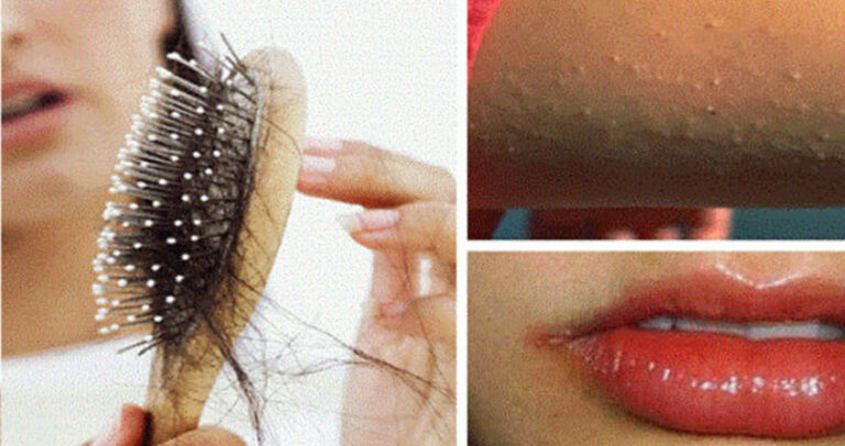 Πώς θα ανακαλύψετε αν έχετε έλλειψη βιταμινών