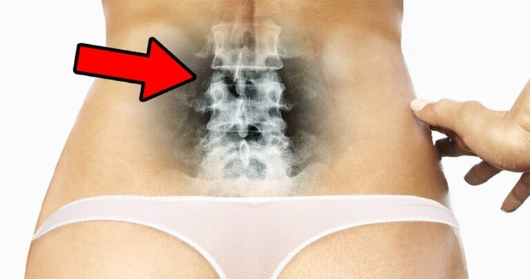 4 απλές ασκήσεις που θα βελτιώσουν την στάση του σώματός σας