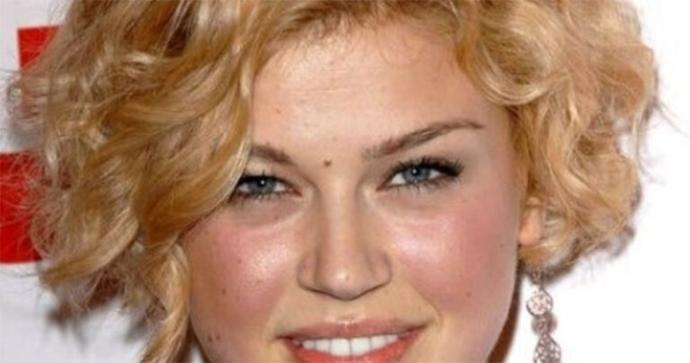 Οι ελιές στο σώμα μας αποκαλύπτουν χαρακτηριστικά της προσωπικότητάς μας