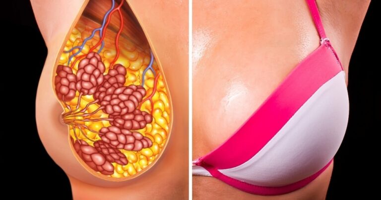 5 φυσικοί τρόποι για να ανορθώσετε το στήθος σας και να του δώσετε το τέλειο σχήμα