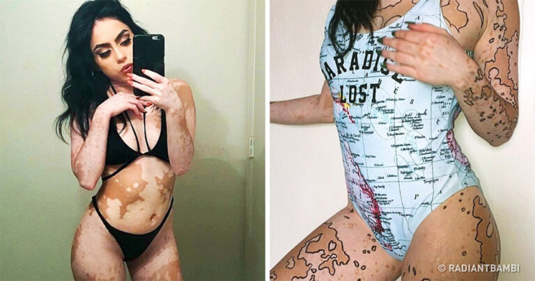 20 φωτογραφίες γυναικών που αποδεικνύουν ότι η ομορφιά πηγάζει από μέσα μας