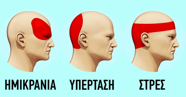 Να πώς θα ξεφορτωθείτε τους πονοκεφάλους σε 5 λεπτά χωρίς χάπια
