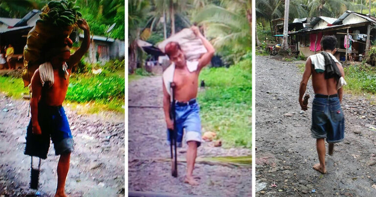 Πατέρας με ένα πόδι κουβαλά 50 κιλά μπανάνες την ημέρα για να προσφέρει στην οικογένειά του