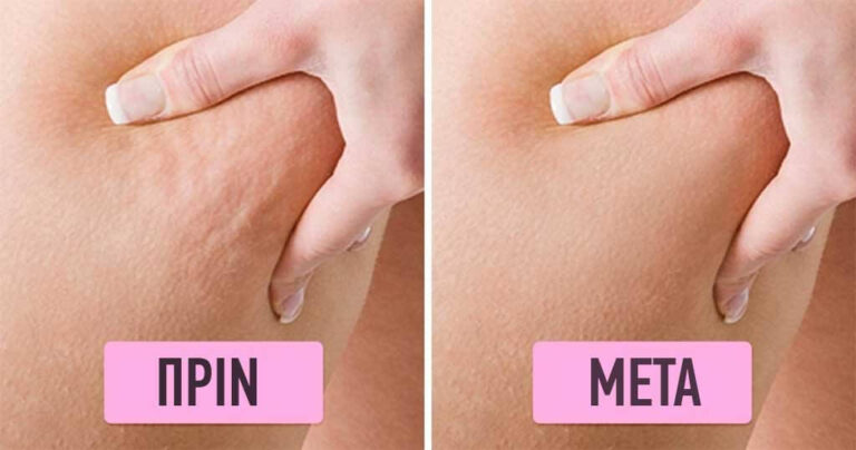 Αυτές οι αποτελεσματικές θεραπείες για το δέρμα και τα μαλλιά μπορούν να φτιαχτούν σε κάθε σπίτι