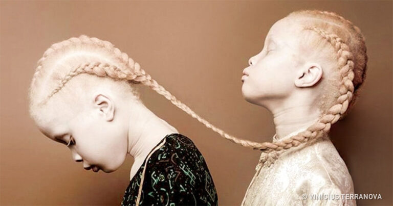 Σπάνια δίδυμα εντυπωσιάζουν όλο τον πλανήτη με τις μοναδικές εμφανίσεις τους