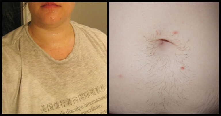 14 προβλήματα υγείας που ντρεπόμαστε να πούμε αλλά δεν πρέπει με τίποτα να αγνοούμε