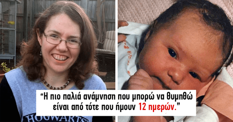 H ιστορία της γυναίκας με την σπάνια πάθηση που θυμάται κάθε μέρα της ζωής της