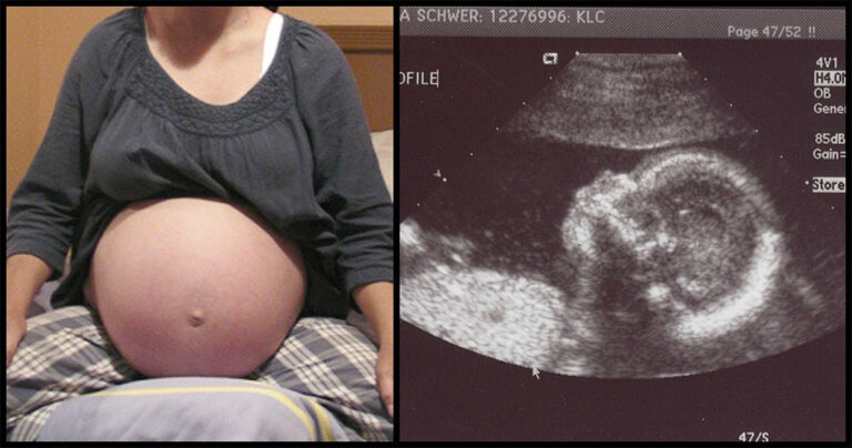 18 περίεργοι λόγοι για να καταλάβετε αν θα κάνετε αγόρι ή κορίτσι