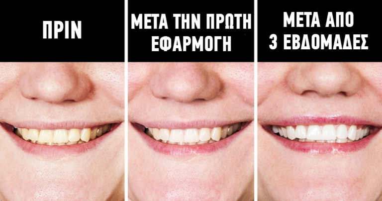 12 περιπτώσεις που το υπεροξείδιο του υδρογόνου δίνει λύσεις στην καθημερινότητα μας