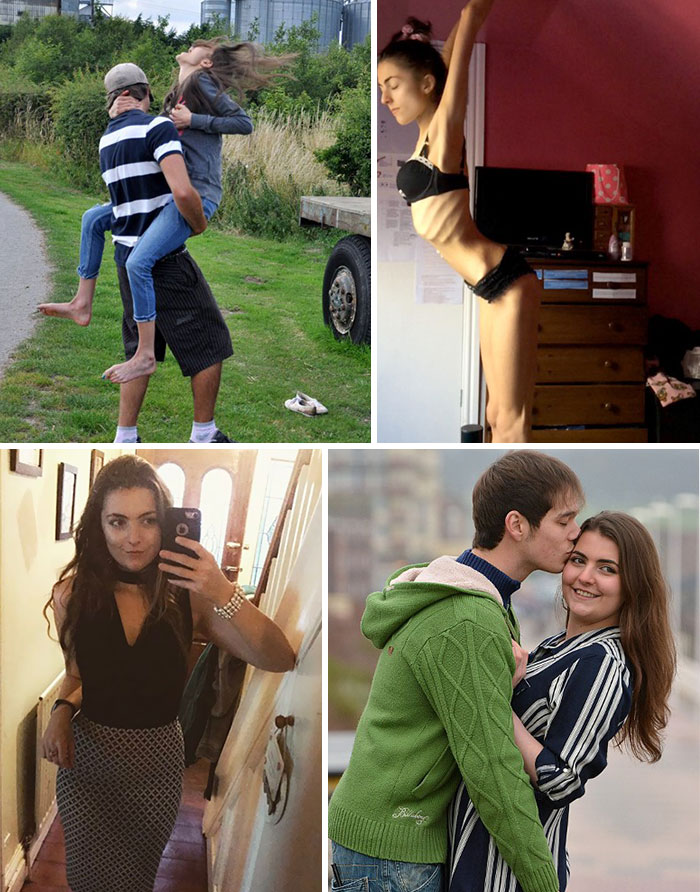 Georgia Mcgrath Was So Frail That Her Ribs Snapped When She Jumped Into Her Boyfriend's Arms But She’s Now Made An Incredible Recovery