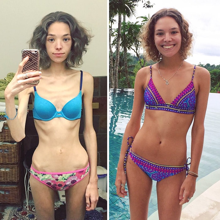 8 Months And 20kg Later