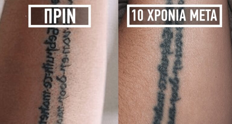 35 φωτογραφίες που δείχνουν πως γίνονται τα τατουάζ μετά από πολύ καιρό