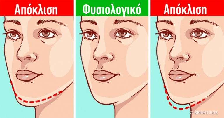 Τι μας αποκαλύπτει το πιγούνι μας για την υγεία μας