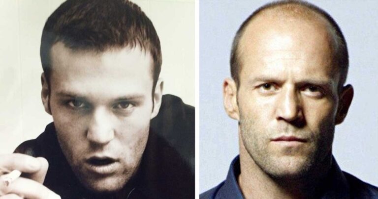 12 πολύ διάσημοι ηθοποιοί λίγο πριν καραφλιάσουν