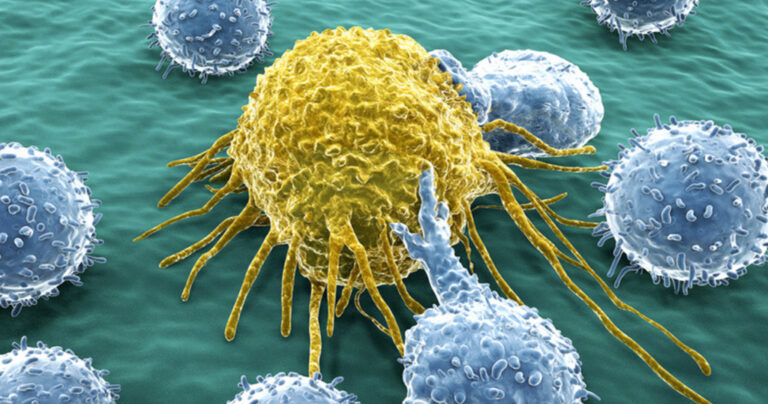 Ανακαλύφθηκε αντίσωμα που μειώνει την ανάπτυξη των καρκινικών όγκων