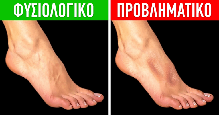 6 απλά τεστ για να ελέγξετε μόνοι σας την υγεία σας