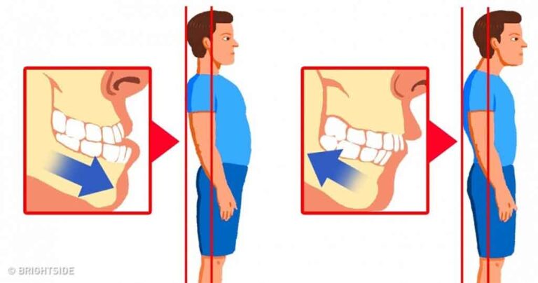 10 εύκολοι τρόποι για να βελτιώσετε την στάση του σώματος συν μια σημαντική πληροφορία