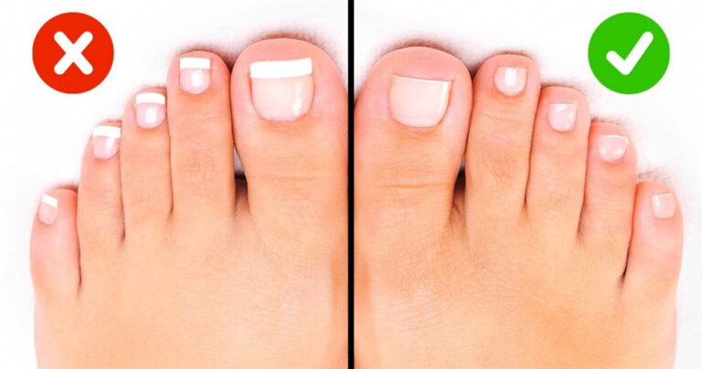 11 μυστικά για να μην μυρίζουν ποτέ ξανά τα πόδια σας