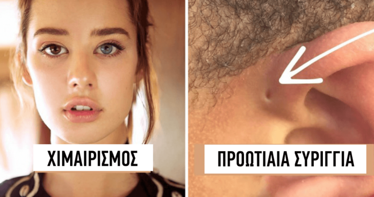 10 σπάνια χαρακτηριστικά που εμφανίζονται μία φορά για κάθε 1.000.000 ανθρώπους