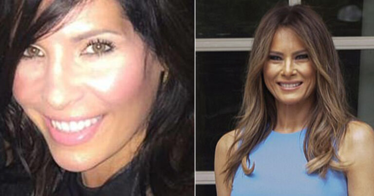 Γυναίκα που θέλει να μοιάσει στη Μελάνια πρόκειται να κάνει 8 πλαστικές επεμβάσεις