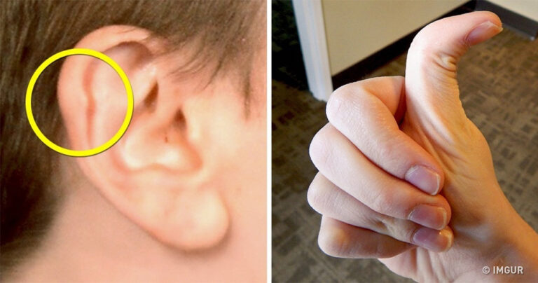 11 απροσδόκητα σημάδια ότι έχετε ένα μοναδικό σώμα