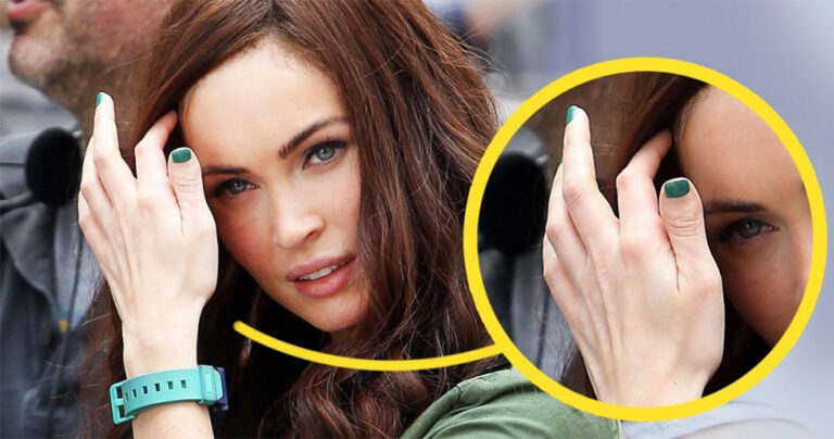 9 διάσημοι που οι ατέλειές τους δεν τους χαλάνε καθόλου την εικόνα