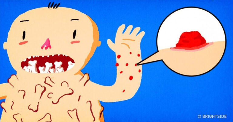 3 σοβαρά σημάδια ότι έχετε μια αλλεργική αντίδραση