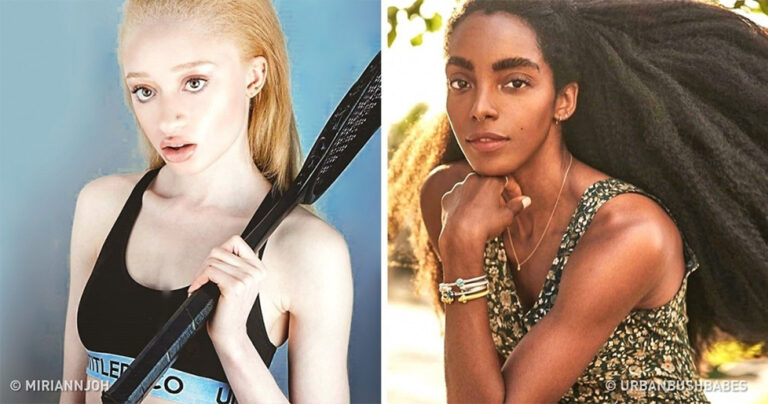 10 μοντέλα που αποδεικνύουν ότι κάθε γυναίκα είναι τέλεια